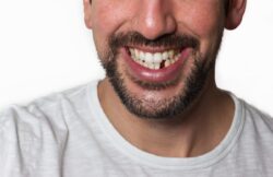 Restore your smile with dental implants by filling in the gaps